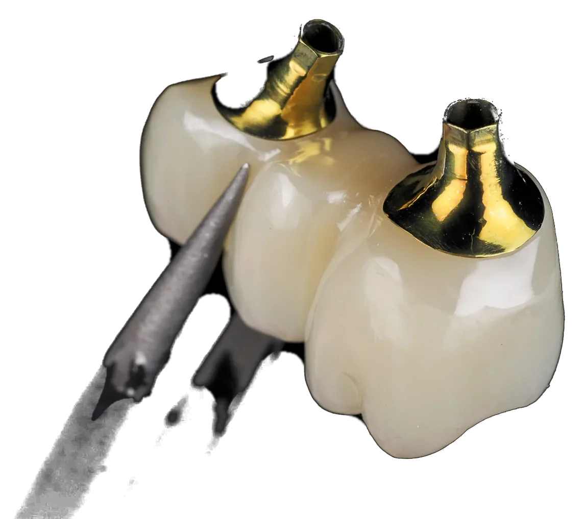 Working Splints DMC Lab — digital dental laboratory in Astana