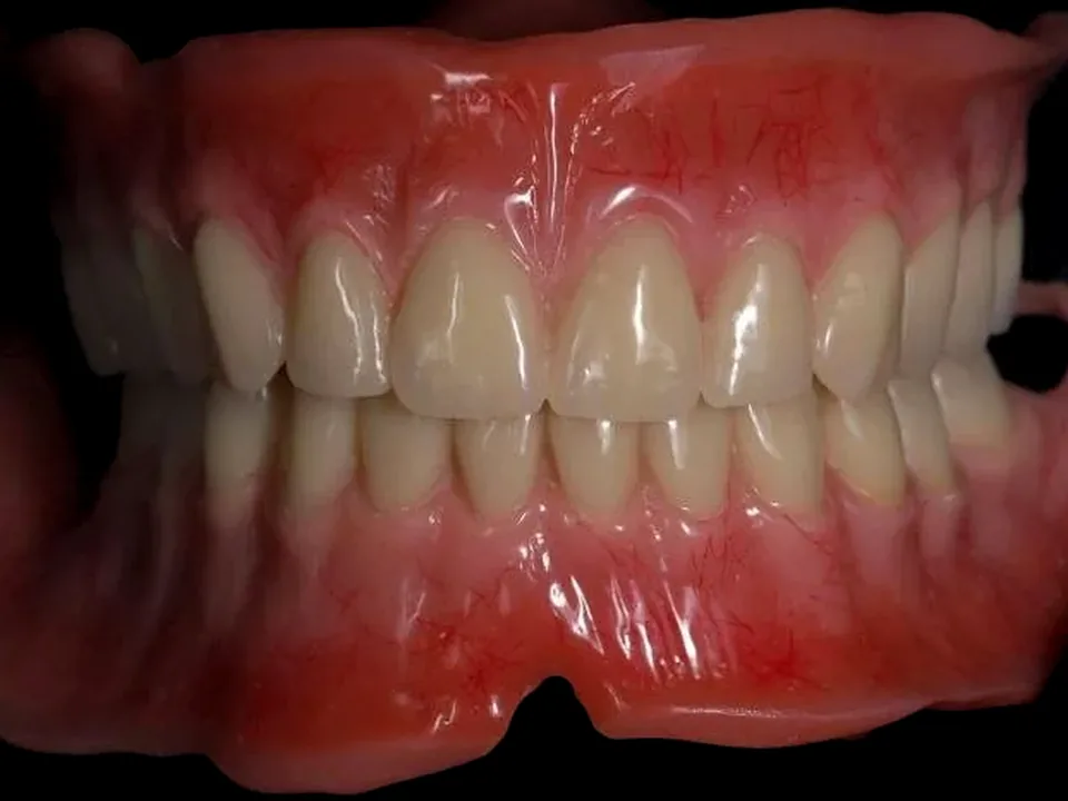 Complete dentures, front view