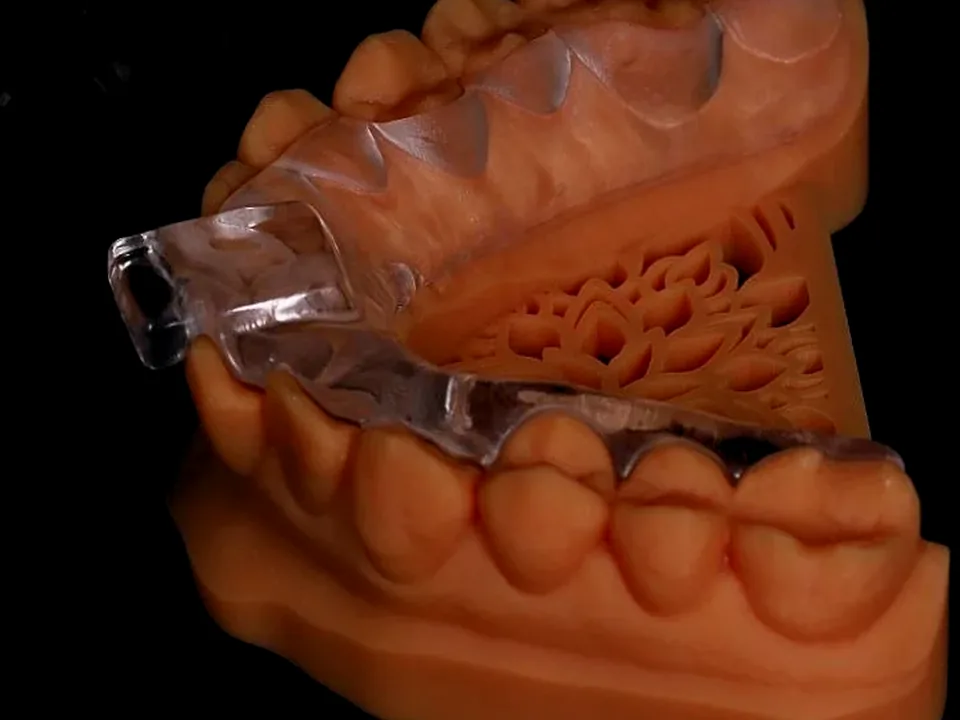 Occlusal splint on printed models